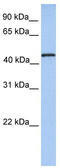 TRNA Methyltransferase 11 Homolog antibody, TA346691, Origene, Western Blot image 