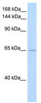 Zinc finger RNA-binding protein antibody, TA345189, Origene, Western Blot image 