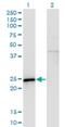 Sperm Autoantigenic Protein 17 antibody, H00053340-M03, Novus Biologicals, Western Blot image 