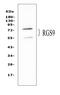 Regulator Of G Protein Signaling 9 antibody, PA2241, Boster Biological Technology, Western Blot image 