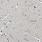 Serine Protease 12 antibody, NBP1-89925, Novus Biologicals, Immunohistochemistry frozen image 