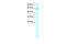 Tripartite motif-containing protein 15 antibody, 28-155, ProSci, Immunohistochemistry paraffin image 