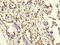 MAGE-3 antigen antibody, LS-C675135, Lifespan Biosciences, Immunohistochemistry paraffin image 