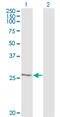 Heat Shock Protein Family B (Small) Member 1 antibody, LS-C197469, Lifespan Biosciences, Western Blot image 
