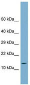 Chromosome 14 Open Reading Frame 119 antibody, TA344951, Origene, Western Blot image 