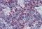 Lymphocyte Cytosolic Protein 2 antibody, PA1-19378, Invitrogen Antibodies, Immunohistochemistry paraffin image 