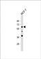 Apurinic/Apyrimidinic Endodeoxyribonuclease 2 antibody, PA5-72607, Invitrogen Antibodies, Western Blot image 