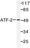 Activating Transcription Factor 2 antibody, LS-C175928, Lifespan Biosciences, Western Blot image 