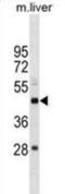 SET Domain Containing 4 antibody, abx030125, Abbexa, Western Blot image 