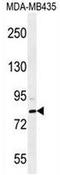 SET And MYND Domain Containing 4 antibody, AP53955PU-N, Origene, Western Blot image 