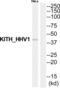Thymidine kinase antibody, abx015068, Abbexa, Western Blot image 