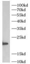 Uridine-Cytidine Kinase 2 antibody, FNab10740, FineTest, Western Blot image 