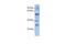 Glutamate Decarboxylase Like 1 antibody, GTX45136, GeneTex, Western Blot image 