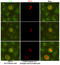 Sirtuin 2 antibody, STJ99093, St John