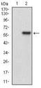 Hypoxanthine Phosphoribosyltransferase 1 antibody, NBP2-37245, Novus Biologicals, Western Blot image 