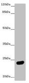 Muscle RAS Oncogene Homolog antibody, LS-C676070, Lifespan Biosciences, Western Blot image 