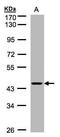 Zinc Finger Protein 134 antibody, PA5-27800, Invitrogen Antibodies, Western Blot image 
