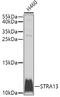 Centromere Protein X antibody, A32276, Boster Biological Technology, Western Blot image 