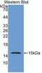 NPHS1 Adhesion Molecule, Nephrin antibody, LS-C295552, Lifespan Biosciences, Western Blot image 