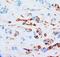 Junction Plakoglobin antibody, LS-C171892, Lifespan Biosciences, Immunohistochemistry paraffin image 