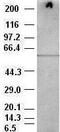 RAC-gamma serine/threonine-protein kinase antibody, GTX84906, GeneTex, Western Blot image 