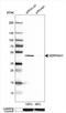 Serpin Family H Member 1 antibody, NBP1-88172, Novus Biologicals, Western Blot image 