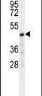 Carbohydrate Sulfotransferase 2 antibody, PA5-24197, Invitrogen Antibodies, Western Blot image 