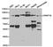 DNA Methyltransferase 3 Alpha antibody, TA327251, Origene, Western Blot image 