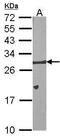 Bcl-XS antibody, TA308852, Origene, Western Blot image 