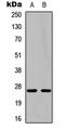 Nerve Growth Factor antibody, abx121656, Abbexa, Western Blot image 