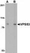 VPS53 Subunit Of GARP Complex antibody, TA306570, Origene, Western Blot image 