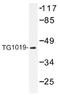 Oxoeicosanoid Receptor 1 antibody, AP01438PU-N, Origene, Western Blot image 