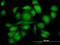 Radixin antibody, H00005962-M06, Novus Biologicals, Immunofluorescence image 