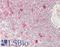 RBP-JK antibody, LS-B14019, Lifespan Biosciences, Immunohistochemistry paraffin image 