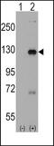 Dishevelled Associated Activator Of Morphogenesis 1 antibody, PA5-12293, Invitrogen Antibodies, Western Blot image 