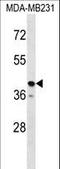 Taste 2 Receptor Member 31 antibody, LS-C161712, Lifespan Biosciences, Western Blot image 