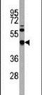 TGFB Induced Factor Homeobox 1 antibody, PA5-14151, Invitrogen Antibodies, Western Blot image 