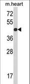 RGP1 Homolog, RAB6A GEF Complex Partner 1 antibody, LS-C162567, Lifespan Biosciences, Western Blot image 