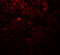 Thyroid Hormone Receptor Interactor 12 antibody, 7953, ProSci, Immunofluorescence image 