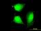 Coiled-Coil Domain Containing 83 antibody, MA5-23184, Invitrogen Antibodies, Immunofluorescence image 