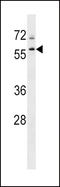 Transducin Beta Like 1 X-Linked Receptor 1 antibody, LS-C161745, Lifespan Biosciences, Western Blot image 