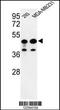 Regulator Of Chromosome Condensation 1 antibody, LS-C162515, Lifespan Biosciences, Western Blot image 