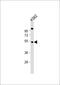 Eukaryotic Translation Initiation Factor 2B Subunit Gamma antibody, 58-888, ProSci, Western Blot image 