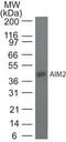 Absent In Melanoma 2 antibody, MA5-16259, Invitrogen Antibodies, Western Blot image 