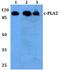Phospholipase A2 Group IVA antibody, A00854, Boster Biological Technology, Western Blot image 