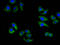 ATP Binding Cassette Subfamily C Member 6 antibody, LS-C680113, Lifespan Biosciences, Immunofluorescence image 