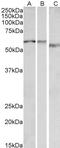 Threonine Synthase Like 2 antibody, 43-223, ProSci, Western Blot image 