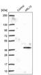 ADP Ribosylation Factor Like GTPase 10 antibody, PA5-61412, Invitrogen Antibodies, Western Blot image 
