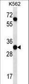 Peptidase Inhibitor 15 antibody, LS-C163698, Lifespan Biosciences, Western Blot image 