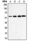 Cholinergic Receptor Nicotinic Alpha 5 Subunit antibody, orb213739, Biorbyt, Western Blot image 